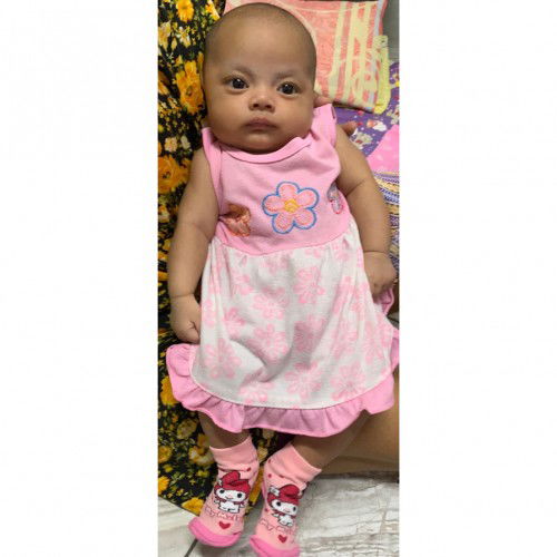 Tips agar rambut cepat tumbuh