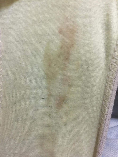 Discharge while Pregnant