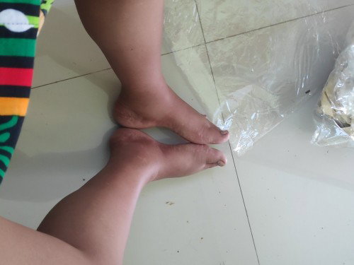 Pagmamanas na pang Krispy Pata