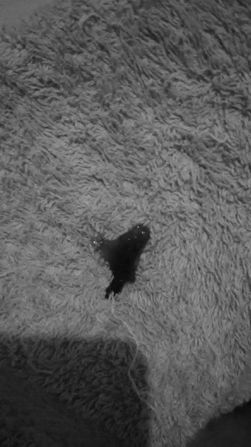 Aku hamil usia 30 minggu (placenta previa)