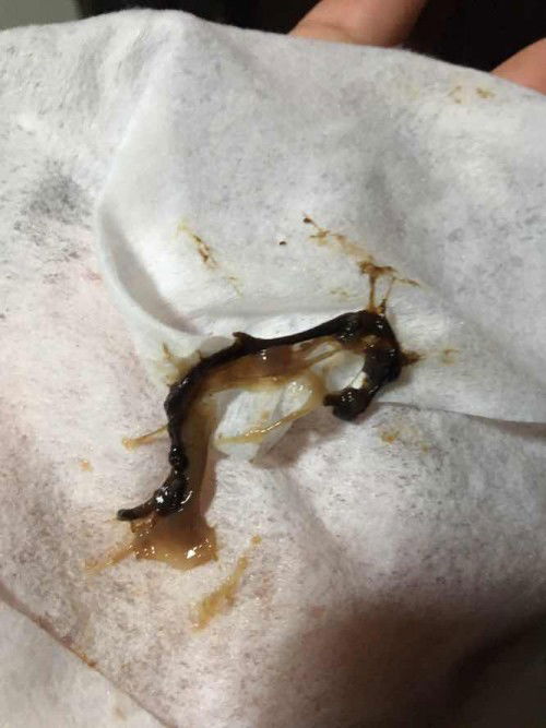 hello update ngayon may lumabas sakit mag ihi kooo ano po ito???? Pero hindi pa masakit yung tyan ko