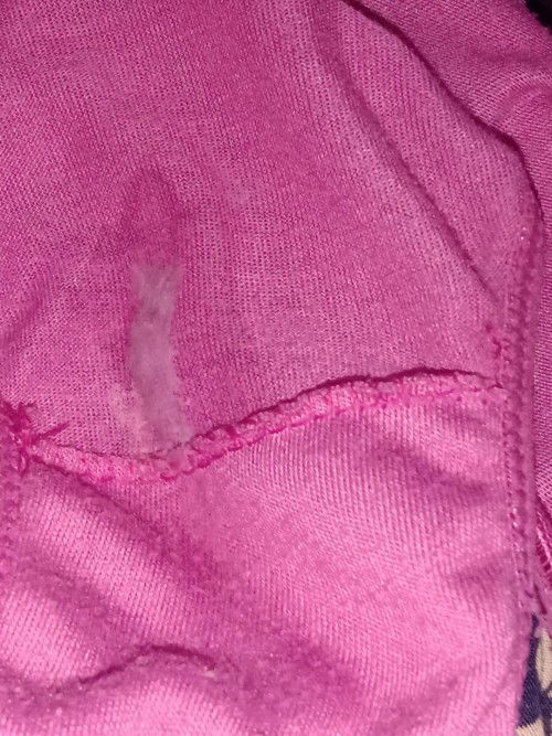 Keluar keputihan di usia 31w