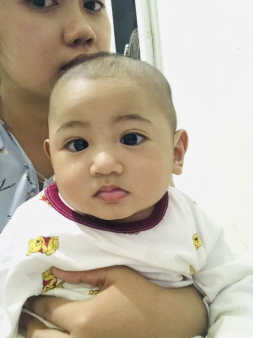 Mata juling umur 6 bulan