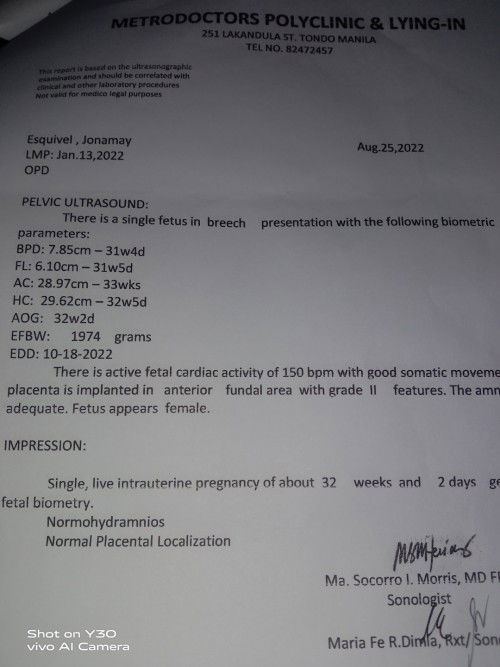 Iikot pa kaya si baby any tips naman panu makanikot si baby nag wowory talaga Ako 😩😭