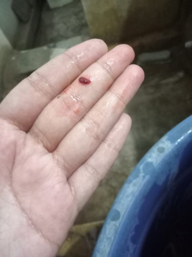 bun,hamil 15wk pas bab kluar darah dr vagina n mncul lendir gtu tanda apa ya bun? apa ak kguguran ??
