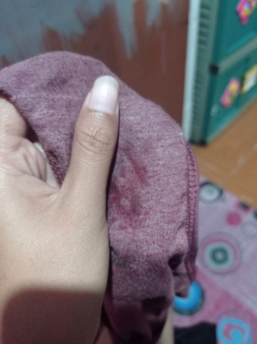 Bangun tidur ada Flek