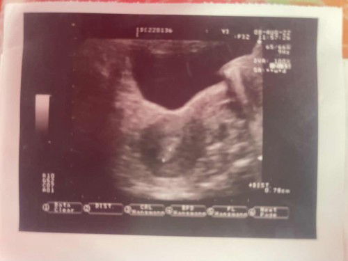 น้องมาแล้ว🎉🎉🎉🎉