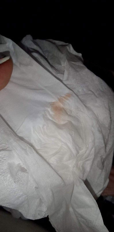 เลือดออก7วีค