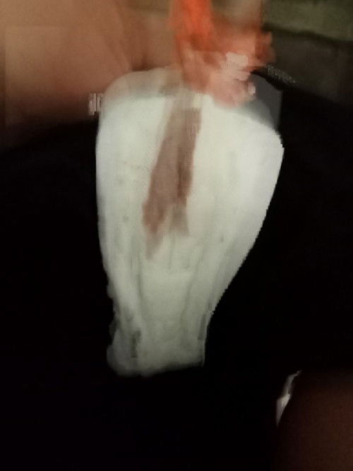 มีเลือดออกแบบนี้อันตรายมั้ยคะ
ภาพอาจดูไม่ดีเท่าไหร่นะคะ