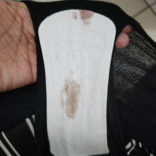 Slight open sa Cervix at 15wks.