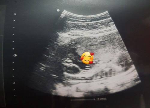 Boy or Girl ?