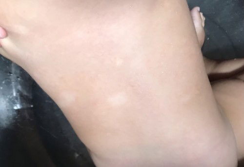 My baby skin problem