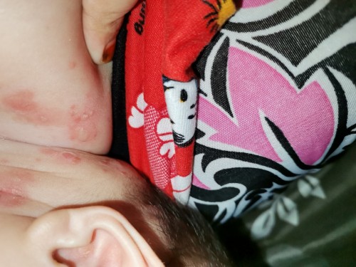 Baka po may nakakaalam ng ganitong tumutubo