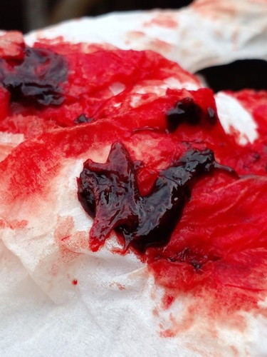 แบบนี้คือน้องหลุดแล้วใช่มั้ยค่ะ😢