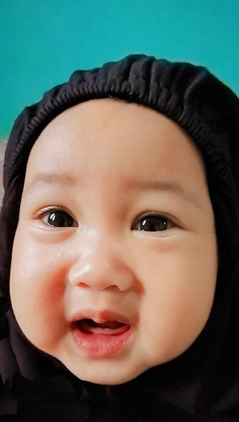 Belum tumbuh gigi