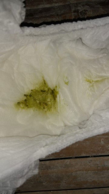 Feses bayi warna ijo