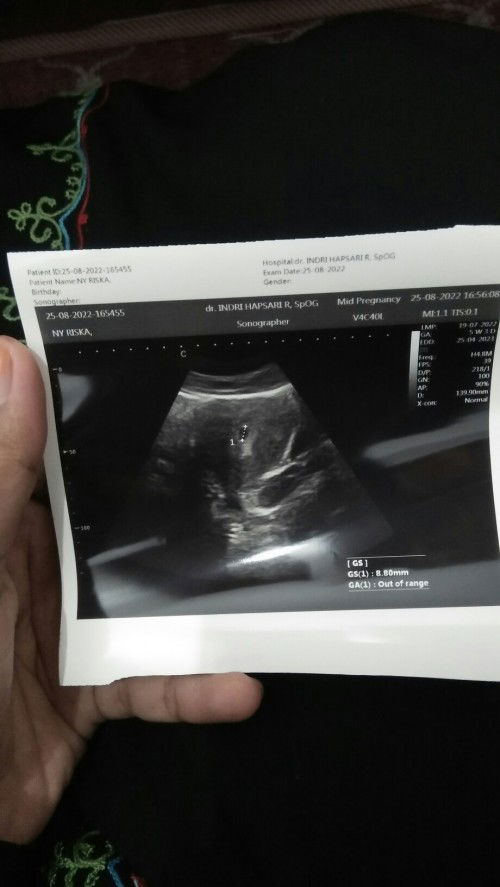 Hamil 5w6d pernah sekali keluar lendir pink