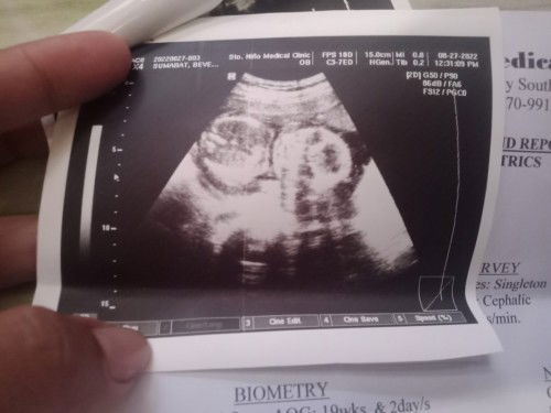 Placenta: Covering the OS