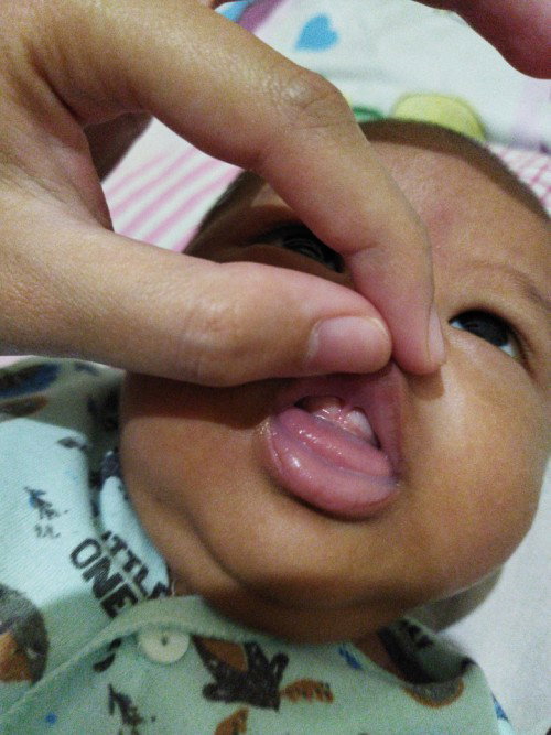 Ini normal kan ya? Barusan baca lip tie jadi takut.