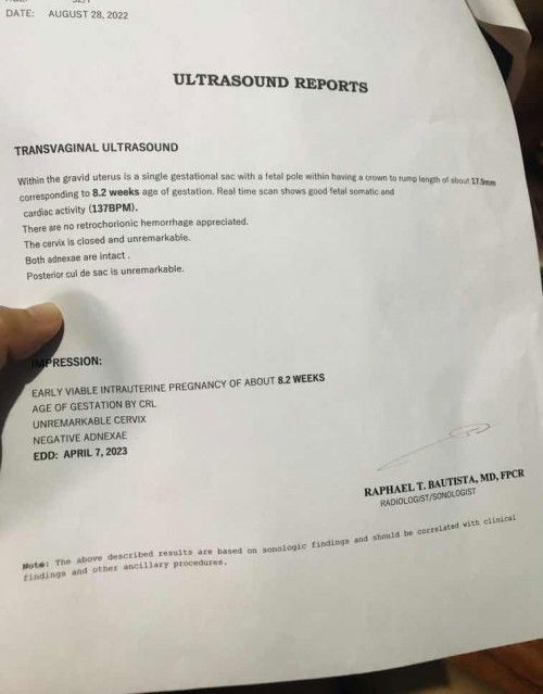 TransV normal lang po ba?