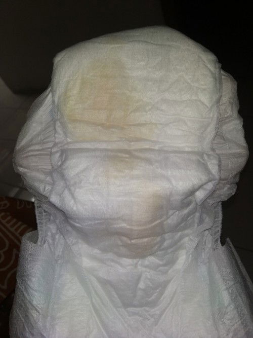 Pipis bayi 2 bulan full ASI berwarna oranye dan bau obat