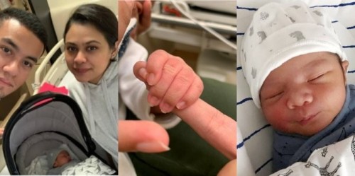 Demi Bertahan Hidup, Bayi Perlukan RM6 Juta Untuk Dapatkan Rawatan Termahal Di Dunia!