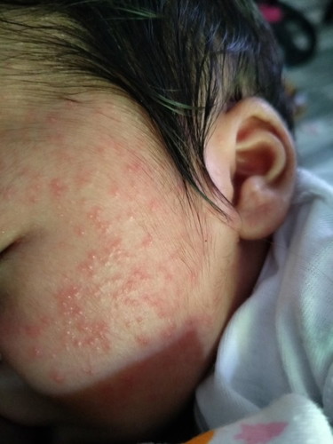 Ask lng po normal lng po ba to sa newborn baby worried po kase ako . 13days old po thanks po