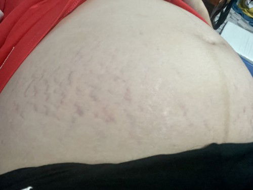 เซ็งมากแม่ ท้องแตกลาย!!! 😩