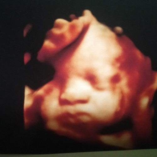 Kepala si urun msih di atas jdi worry