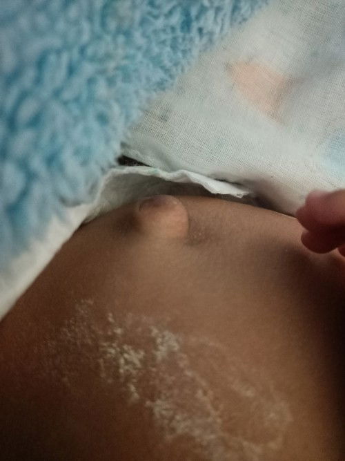 สะดือของลูกน้อย