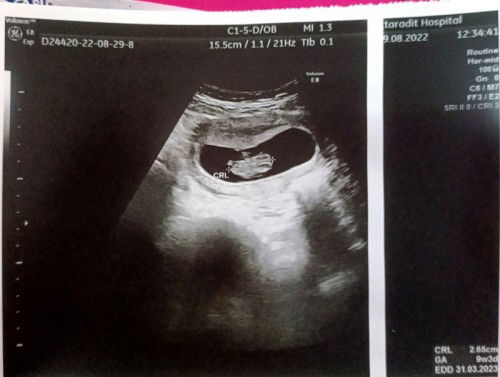 เด็กน้อย9w+3d