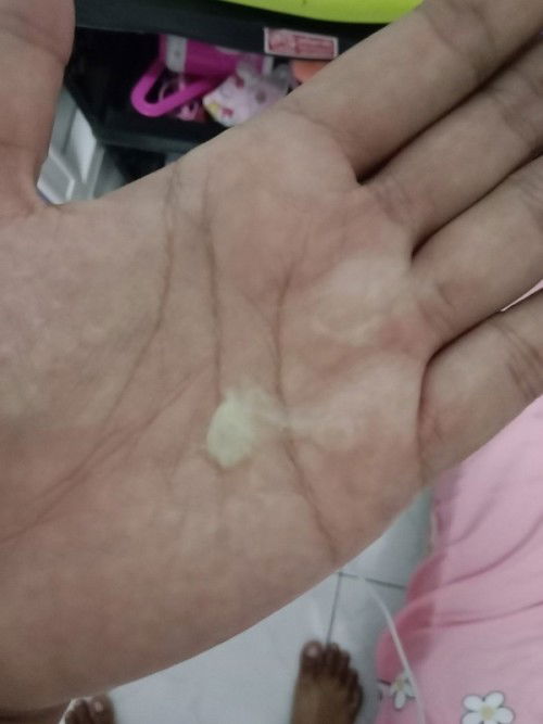 ท้อง 33 weeks มีมูกออกแบบนี้..ปกติไหมค่ะ#ขอคำแนะนำหน่อยค่ะ