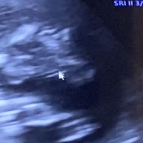 ช หรือ ญคะแบบนี้ช่วยเดาทีค่ะ