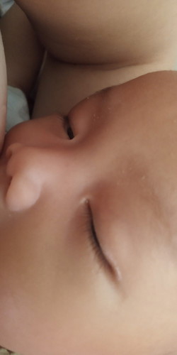 Semacam kerak warna putih di pangkal alis