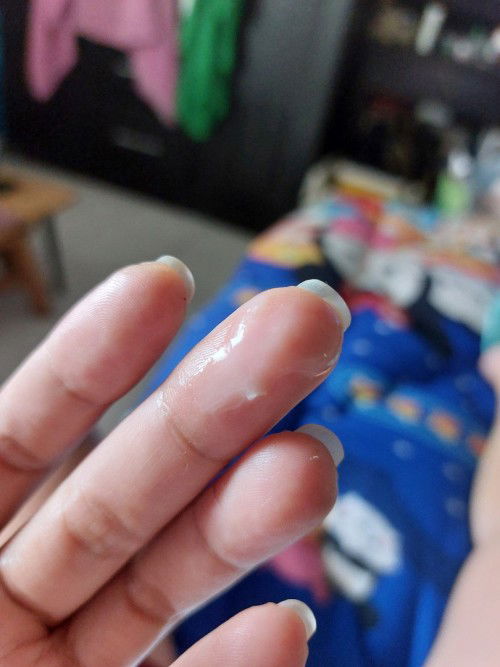 ปวดท้อง มีน้ำไหล