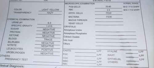 Normal lang po ba resulta Ng urinalysis ko?