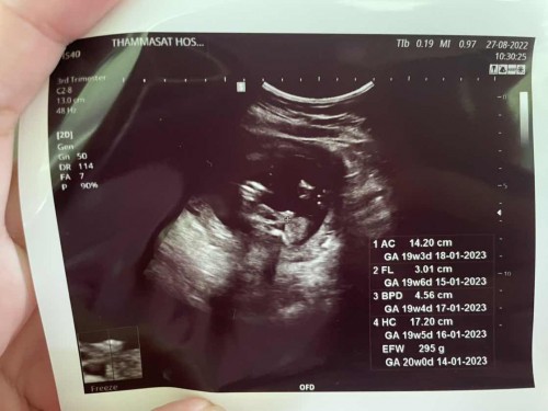 ช่วยแม่ดูเพศน้องหน่อยคร้า