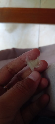 mau nanya niy bund..sy lagi hamil 19 week..knpa ya klo habis hb selalu keluar keputihan berlebih