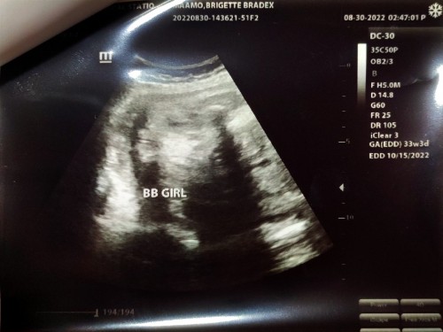 33 weeks and 3 days