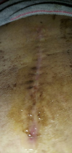 may butas po ba ps: hindi po nana yan sa betadine at ointment po sana may sumagot feel ko may maliit