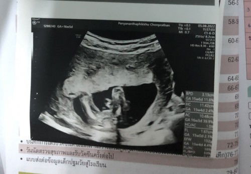 แม่ๆช่วยดูหน่อยค่ะ