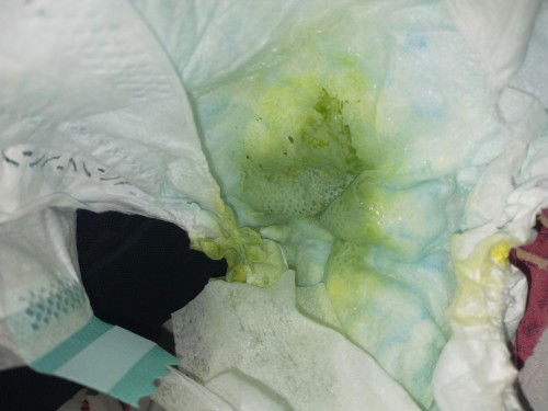5 weeks old baby. Normal Lang po ba ung poop na ganito? Watery green.