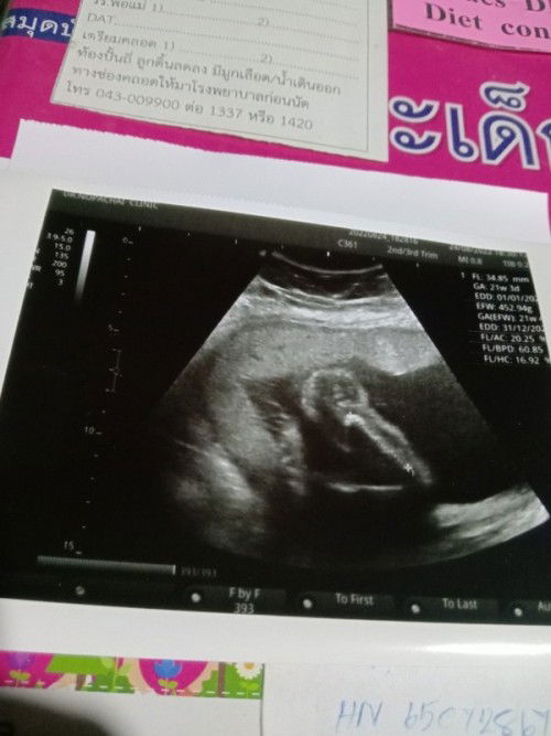 รูปจากอัลตร้าซาวด์