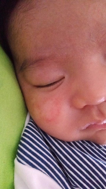 Wajah bayik memerah dan putih