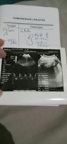 Hasil usg 31 week