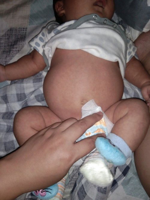 Size and Shape ng tyan ni baby