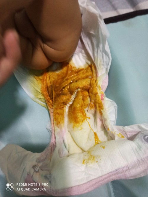 My sipon po si bb .nagt-take sya ng cefaclor ,disudrin at ambroxol mdalas din poop nya pero onti lng