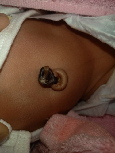 แบบนี้ จะเป็นอะไรไหมคะ