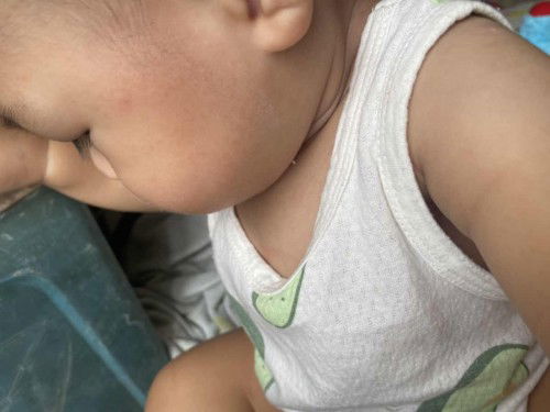 ติดโควิด9เดือน