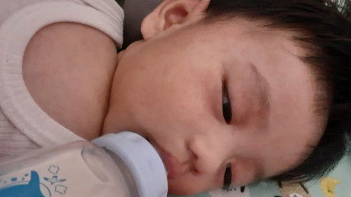 Bayi ruam setelah minum sufor